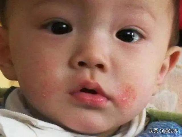 螨虫最怕的土办法，家里老人小孩老过敏
