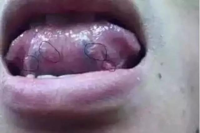 健康的舌头图片，如何判断自己的舌头健康状况（五脏在舌头均有反射区）