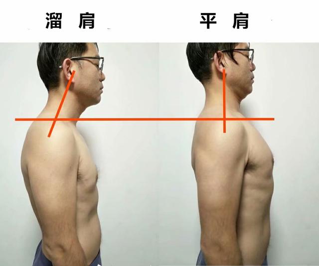 溜肩怎么练成平肩，男生溜肩怎么练成平肩（上斜方肌受着不可承受之重。选对方法）