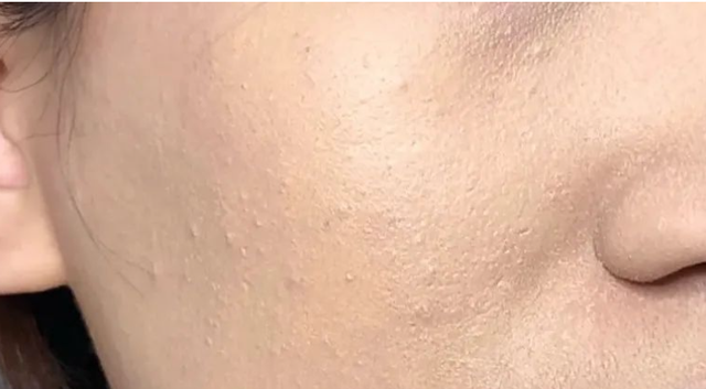 皮肤美白小窍门，皮肤美白小窍门是什么（改善肤色暗沉的4个小技巧）