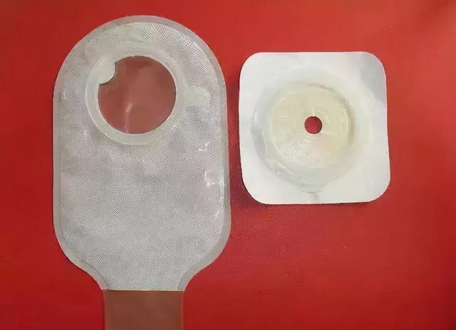 什么情况下要人造肛门，我国“造口人”超百万