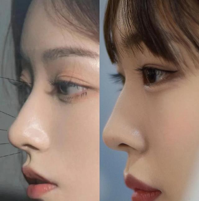 鼻子有哪几种类型,女生好看的4种鼻型水滴鼻很加分 - 玉三网