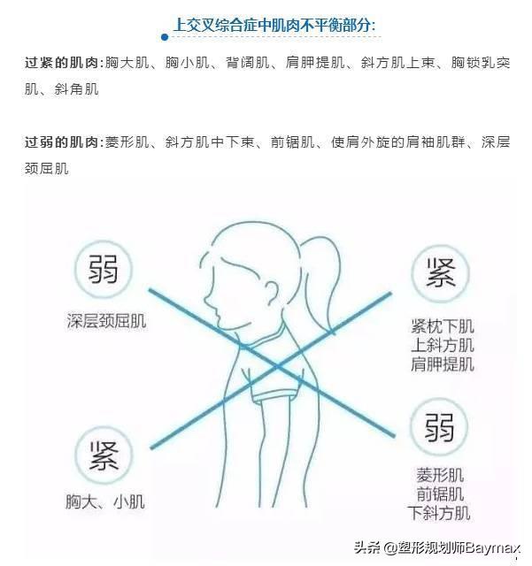 怎么改善驼背，驼背怎么办，怎么改善驼背（6个动作让你恢复挺拔完美体态）