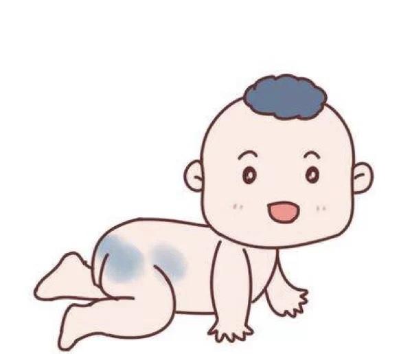 富贵妈妈在怀孕的时候很担心一个问题,就是胎记,要是长在能隐蔽位置