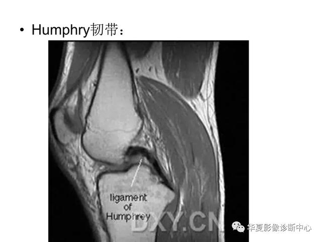 膝关节解剖结构图，膝盖解剖图示意图（膝关节MRI之正常解剖综述）