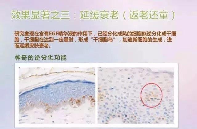冻干粉用在护肤的哪个步骤，冻干粉免洗面膜效果怎么样（冻干粉是什么，有什么作用）