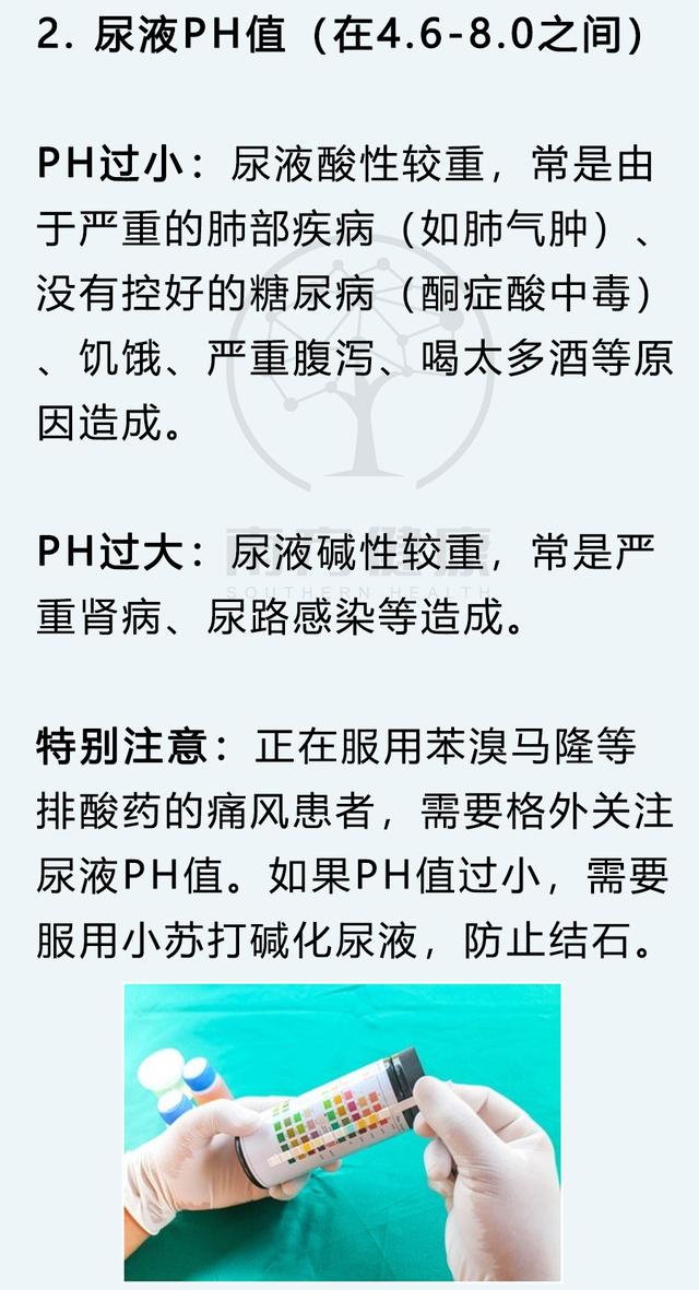 尿常规怎么检查，男性尿常规怎么看（5分钟判断身体健康）