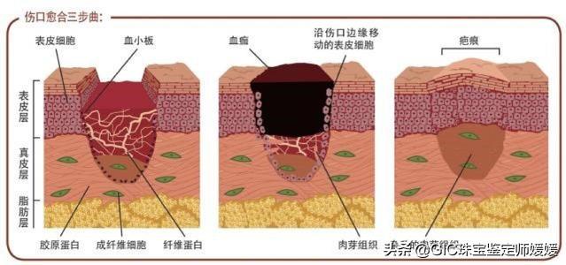 新手戴耳钉小技巧，让你能够顺利地戴上美美的耳环