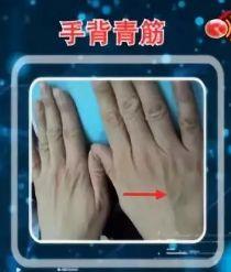 手上动脉在哪里，手上的动脉在哪里（血管好不好，自己看看手就知道）