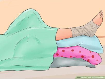 变向是什么意思，xxs是什么意思（每个跑友都应该看一看的崴脚知识）