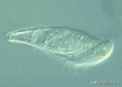 微生物镜检标准是多少，污水处理厂微生物镜检流程与污泥活性分析总结