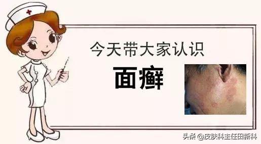 手上皮癣早期症状图片，皮癣的真实图片（你脸上成片“痘印”）