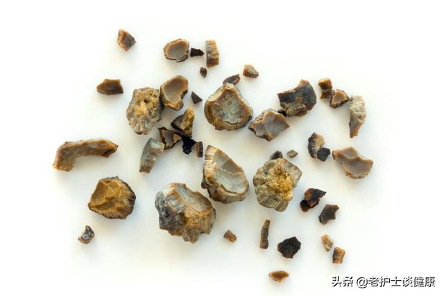 肾结石疼痛怎么办，产妇肾结石疼痛怎么办（肾结石剧痛难忍）