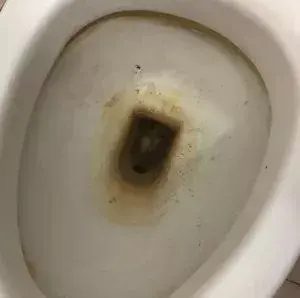 厕所黄污渍怎么去除，厕所发黄清洗的小妙招（保洁阿姨这个小妙招）