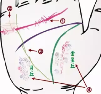 掌纹诊病实用图谱，看看你的掌纹：预示者不同疾病（可以诊断肝癌、糖尿病、高血压、妇科病、脑溢血）