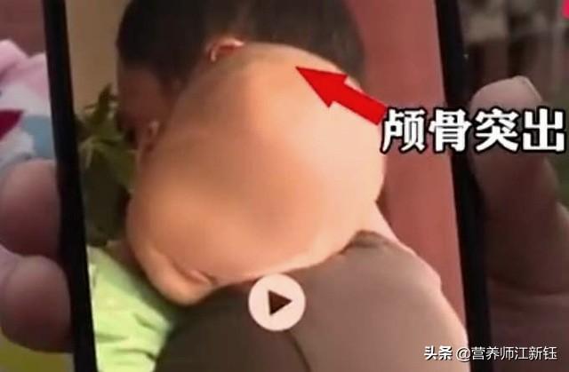 蛋白质固体饮料怎么喝，蛋白质固体饮料怎么喝效果好（以固体饮料充当“特医奶粉”）