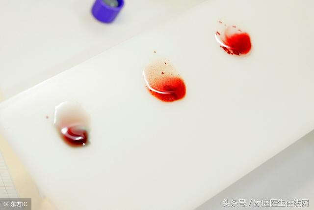 o型血有什么好处，o型血的人有什么好处（这种情况下，O型血不能乱输）
