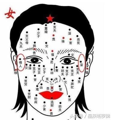 女人颧骨有痣图片