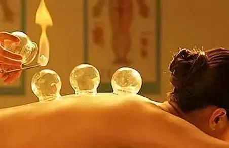 女人背部拔罐的好处和坏处,女性背部拔罐的好处和坏处(你知道为什么选择后背进行拔罐吗) 女人背部拔罐的好处和坏处,女性背部拔罐的好处和坏处(你知道为什么选择后背进行拔罐吗)