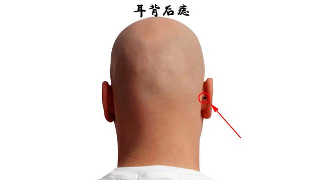 耳朵上长痣代表什么，耳朵上长痣代表什么 好不好（耳朵上长黑痣是什么预兆）