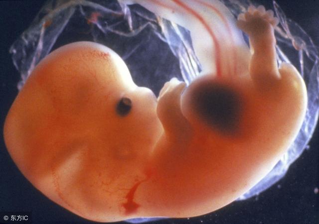 怀孕7周胎儿真实图片图片