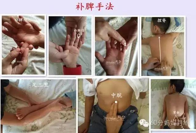 小孩扎四缝有没有危害，小儿扎四缝的副作用（腺样体肥大的危害不只是宝宝张嘴睡）