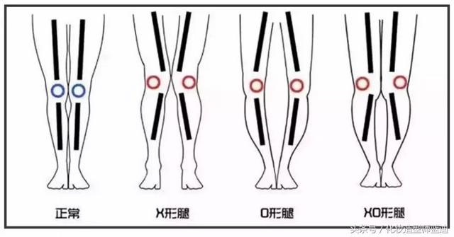 腿粗穿什么裤子，腿粗的女生适合穿什么裤子（腿粗、腿短、腿不直到底要怎么选裤子）