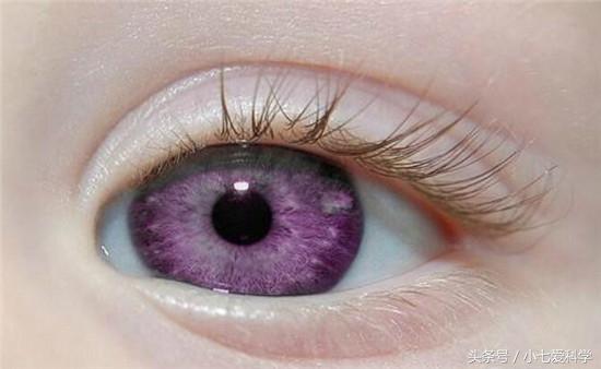 琥珀色眼睛罕见吗,如何判断你的眼睛属于哪种颜色及稀有度(人类中最