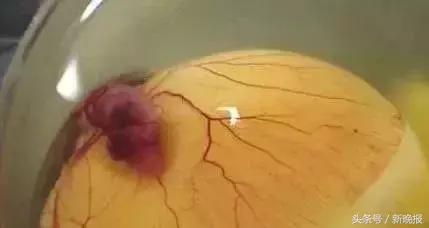 死胎蛋照射的图片，鸭蛋怎么孵化需要准备什么（浙江一母鸡竟生下这样的蛋……养鸡十几年第一次见）