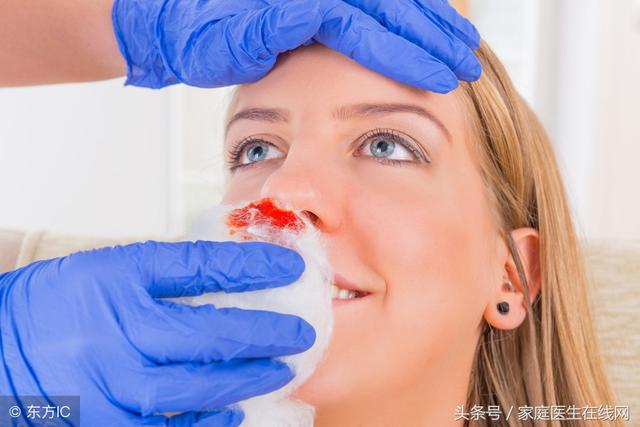 止血方法有哪几种，流鼻血正确的止血方法（采用这9个方式）