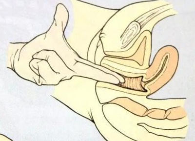 男人分娩疼痛体验12级，