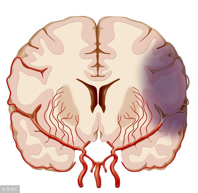 突然头晕目眩站不稳还冒汗，突然头晕目眩是怎么回事（然后几秒又好了）