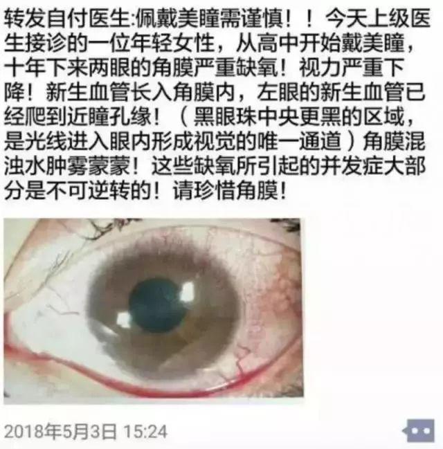 戴美瞳可以哭吗，戴美瞳能哭吗（这盒美瞳可能正在毁掉你的双眼）