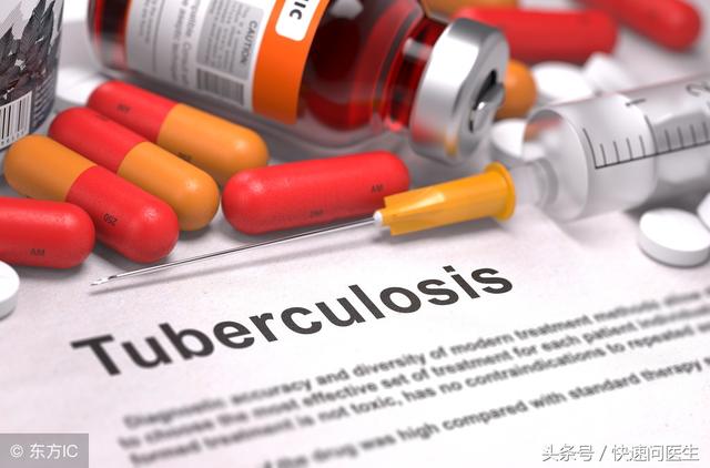 肺结核的潜伏期，肺结核的潜伏期是多久（肺结核病潜伏期难察觉）