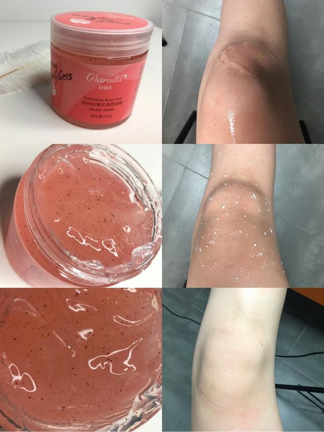 膝盖黑怎么变白，膝盖黑怎麽办？3步让膝盖美白（被忽视多年黢黑的膝盖也能变白）