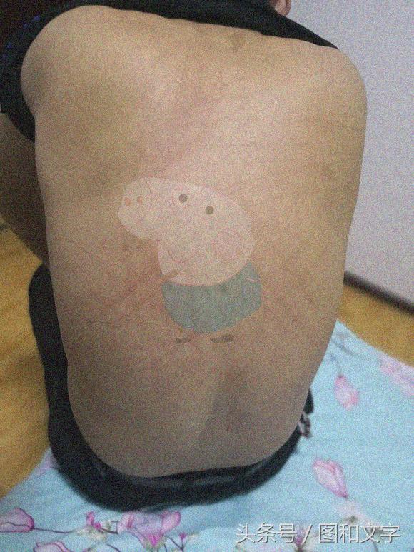 怎么快速P一个纹身，怎么快速p一个纹身图（背让老婆用衣架打青了求大神帮个忙p个纹身上去）