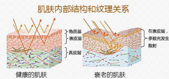 雷达线雕的功效是什么，雷达线雕和线雕区别（什么是雷达精雕和雷达线雕）