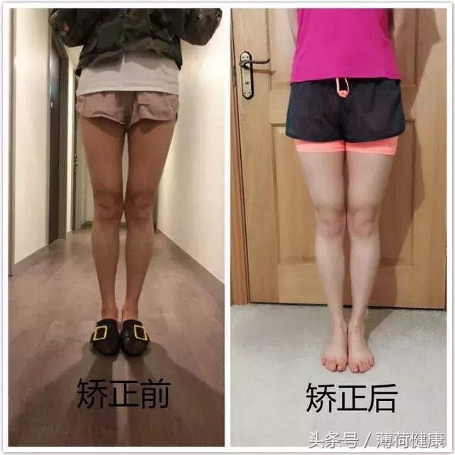 拥有玉腿的好方法，拥有玉腿的好方法有哪些（我用这些方法练出一双修长玉腿）