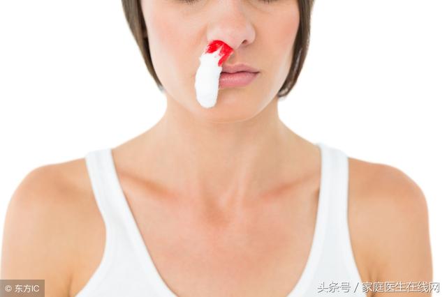鼻子出血是怎么回事儿，突然毫无征兆的流鼻血怎么回事（其实就这3个原因。）