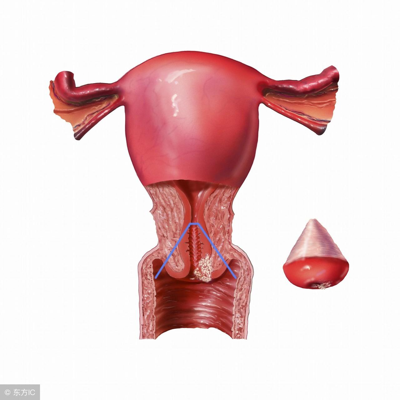 宫颈肥大有什么症状呢?需要哪些妇科检查来排查呢-质信十强榜