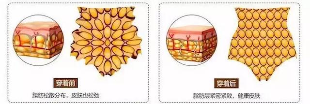 内裤夹档是买大了还是买小了，四岁女宝宝内裤总是夹档怎么办（半个娱乐圈的女星都在穿）
