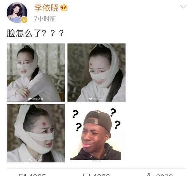 李依晓承认整容，李依晓整容真实经历（《扶摇》大师姐李依晓自曝整容5次）