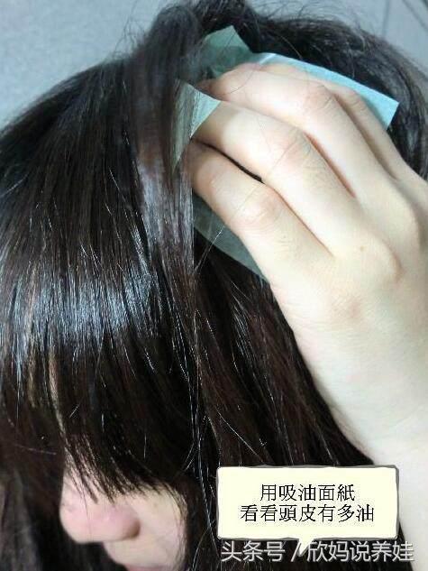 头上长螨虫的图片是什么样的，如何识别头上是否有螨虫（专家提醒：头上有螨虫的人）