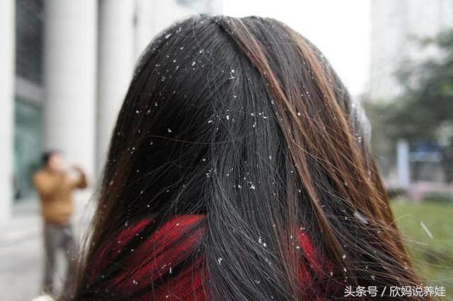 头上长螨虫的图片是什么样的，如何识别头上是否有螨虫（专家提醒：头上有螨虫的人）