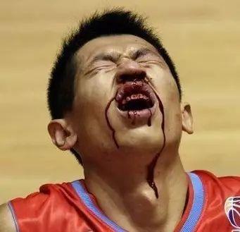 小孩流鼻血怎么办，八岁小孩流鼻血怎么办（医生给出处理方案了）