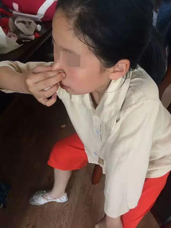 小孩流鼻血怎么办，八岁小孩流鼻血怎么办（医生给出处理方案了）