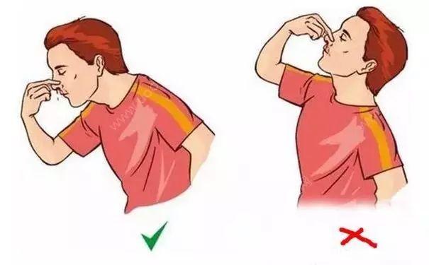 小孩流鼻血怎么办，八岁小孩流鼻血怎么办（医生给出处理方案了）