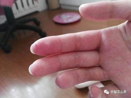 被仓鼠咬了怎么办，被仓鼠咬了要打疫苗吗（咬伤后要怎么处理才是正确的）