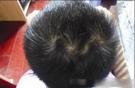 头顶平的女人命好吗(女人头顶2个旋的命) - 珍缘易学