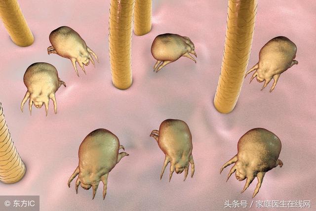 头皮螨虫是什么原因造成的，头上出现这3个迹象